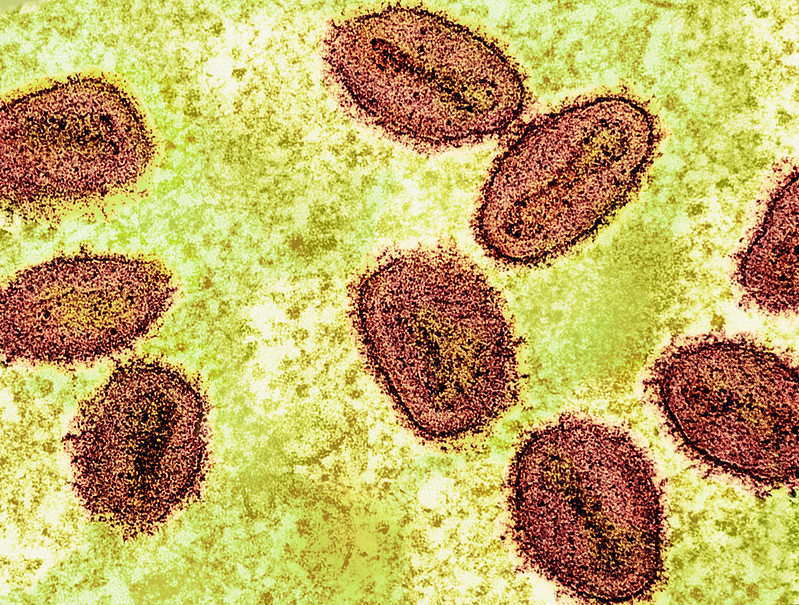 Micrografia eletrônica de transmissão colorida de partículas do vírus mpox (vermelhas) encontradas dentro de uma célula infectada (verde), cultivada em laboratório. Imagem capturada na Instalação Integrada de Pesquisa (IRF) do NIAID em Fort Detrick, Maryland. Crédito: NIAID.